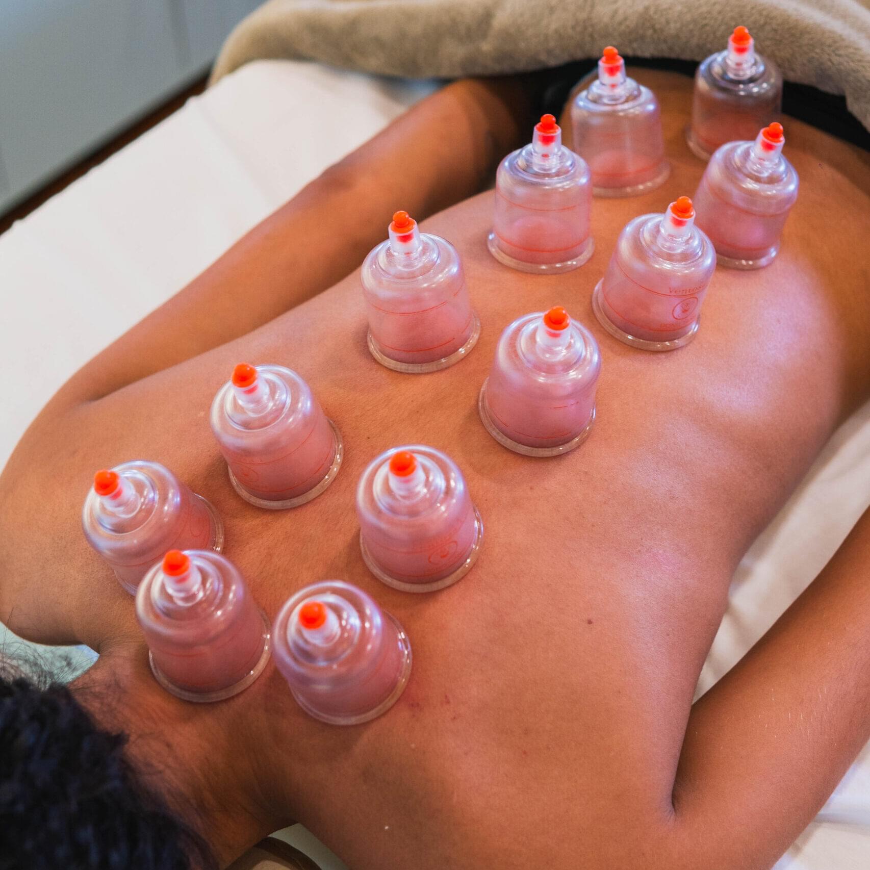 Massagem Local e Ventosaterapia